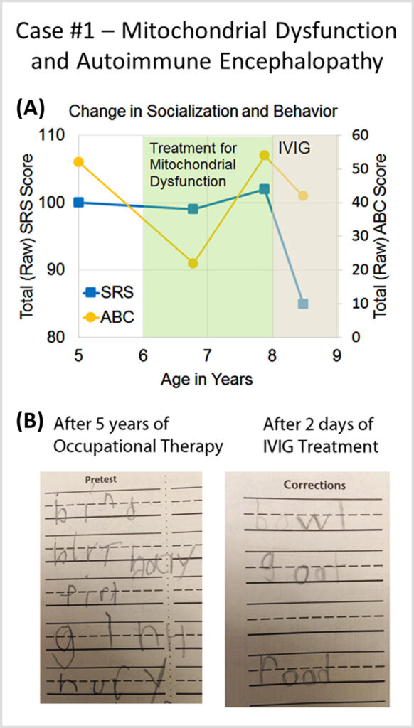 IVIG for the treatment of autoimmune encephalopathy mobile