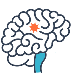 Treatment for basal ganglia encephalitis