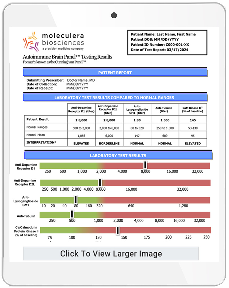 Autoimmune Brain Panel Report