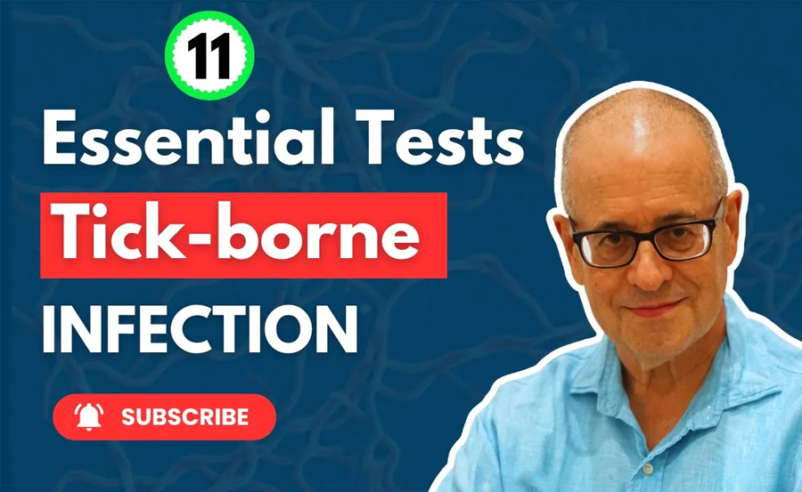 Essential Tests for Tick-borne Infection