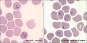 Babesia microti can be confused with Plasmodium falciparum (Source: CDC)